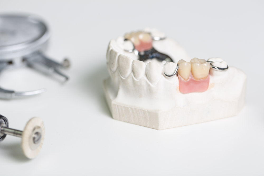 歯科技工士が働く場所の違いを解説