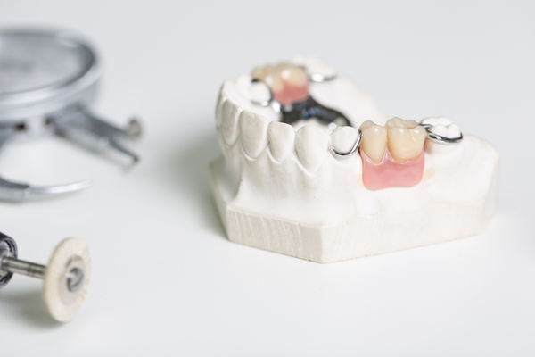 歯科技工に関する専門用語とは？歯科技工士が働く場所の違いを解説